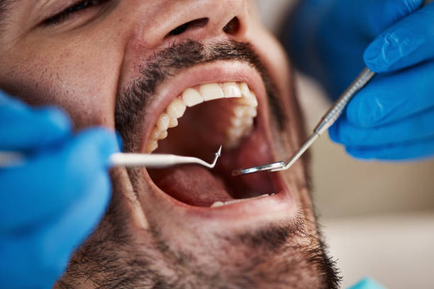 Best Emergency Gum Treatment in Kingfisher, OK